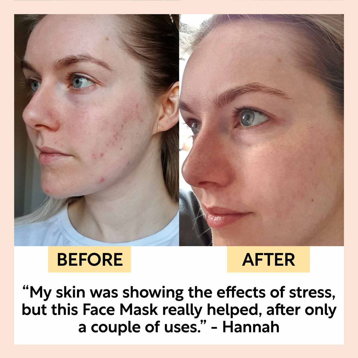 Kaolin Clay Face Mask UpCircle