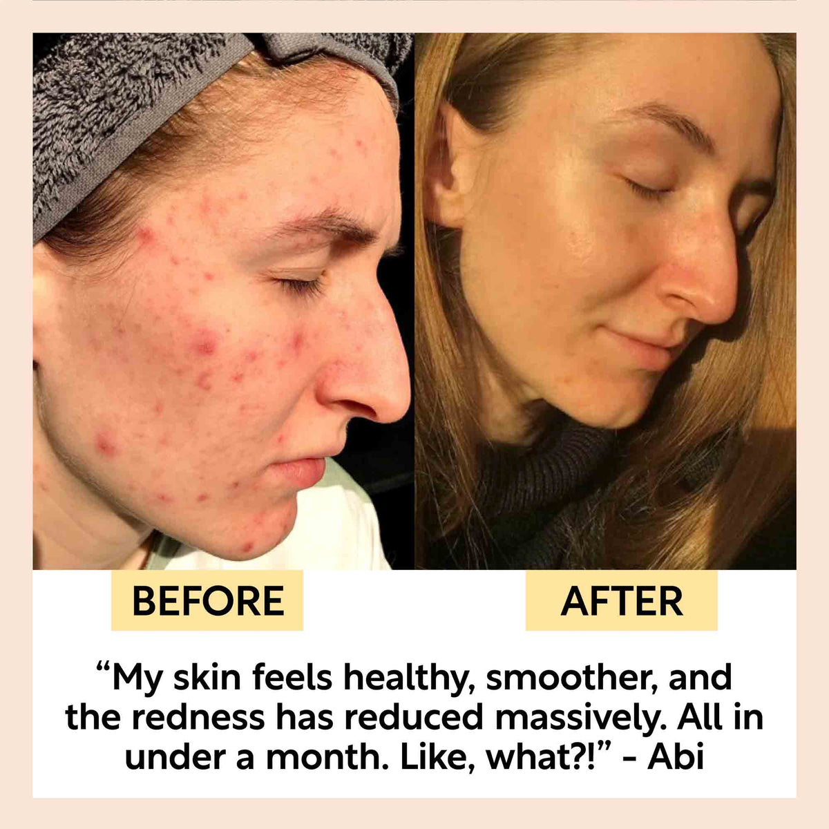 Kaolin Clay Face Mask UpCircle