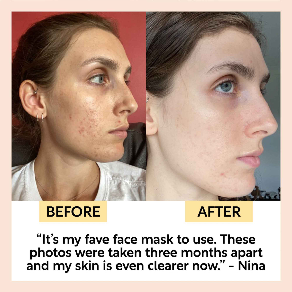 Kaolin Clay Face Mask UpCircle