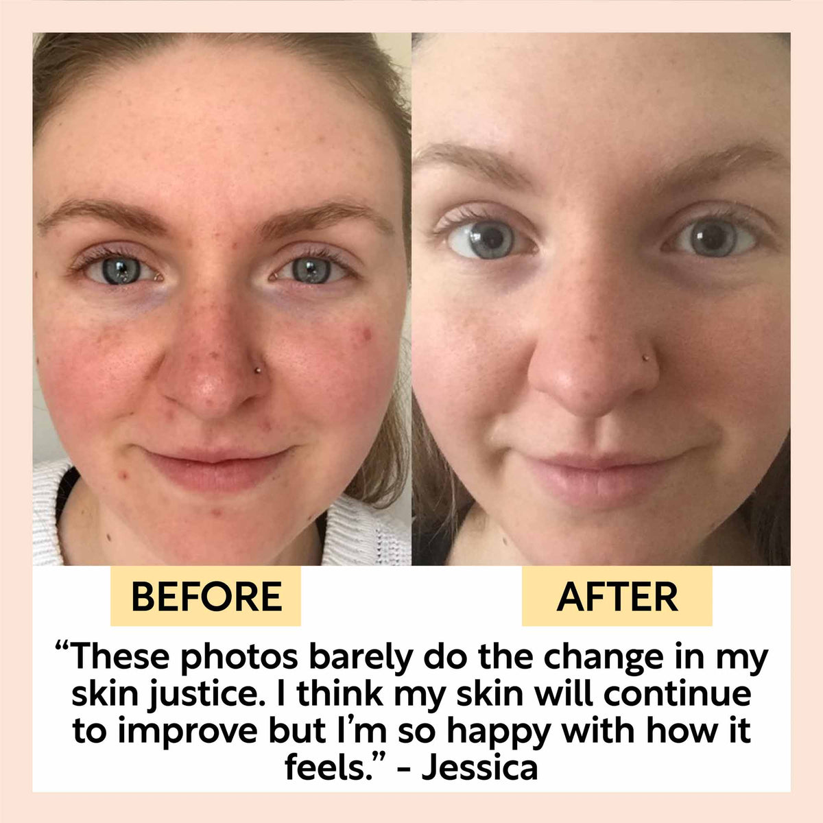 Travel-Size Skincare Bundle UpCircle