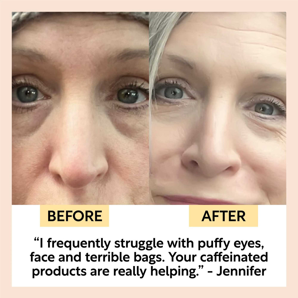 Day + Night Eye Care Bundle UpCircle
