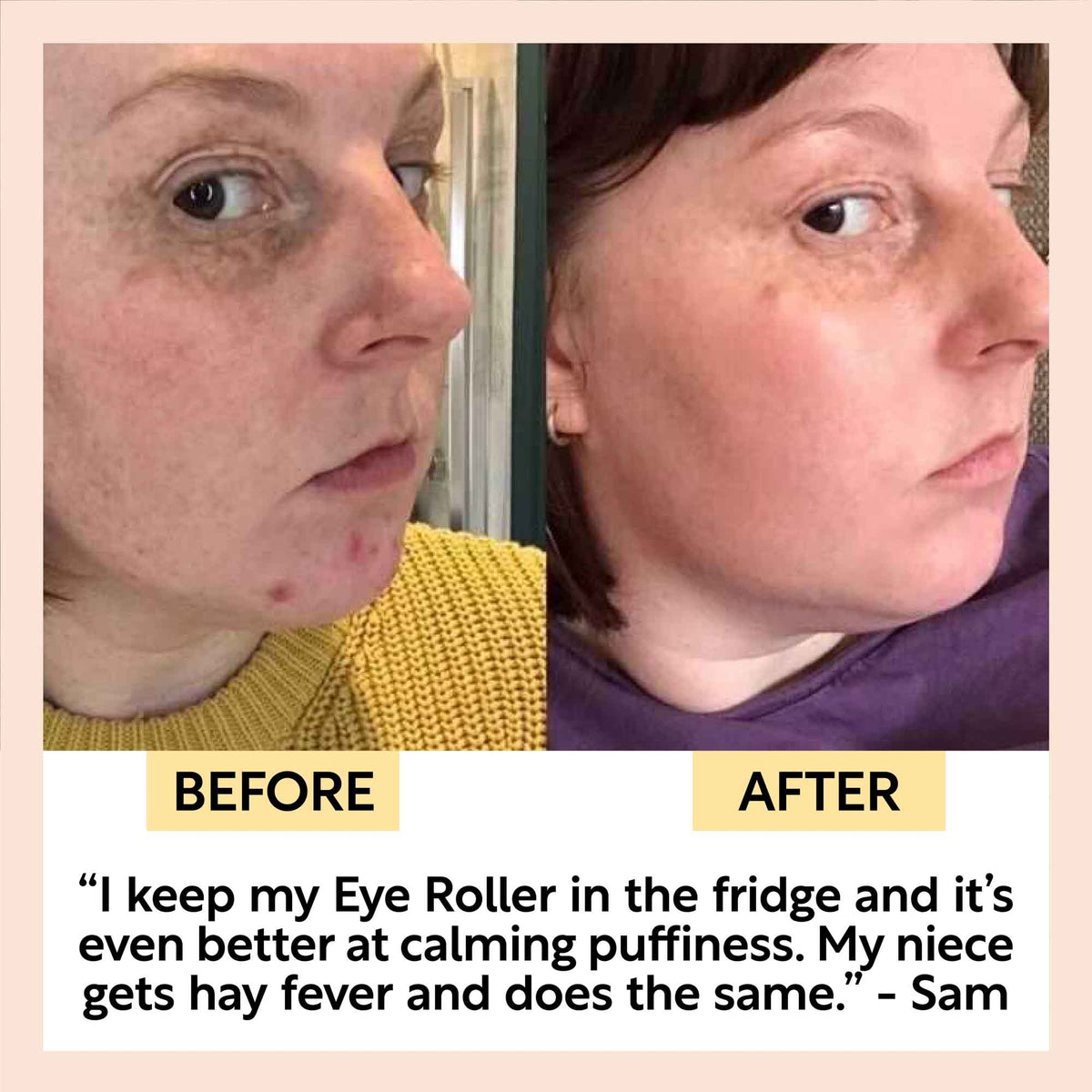 Day + Night Eye Care Bundle UpCircle