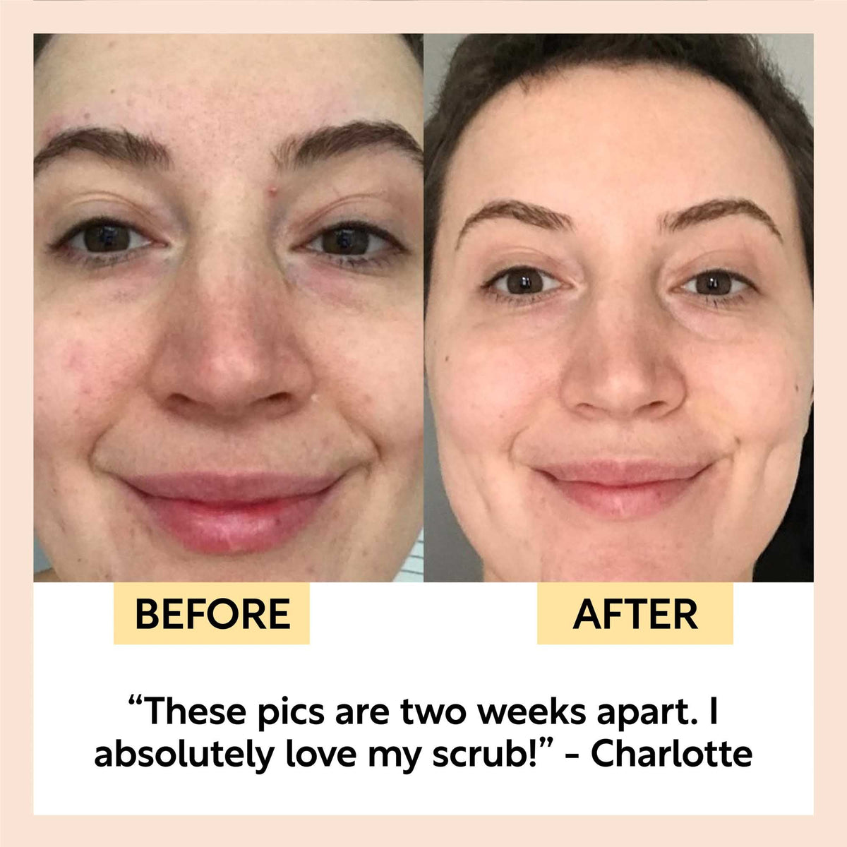 Face Scrub with Coffee + Rosehip Oil UpCircle