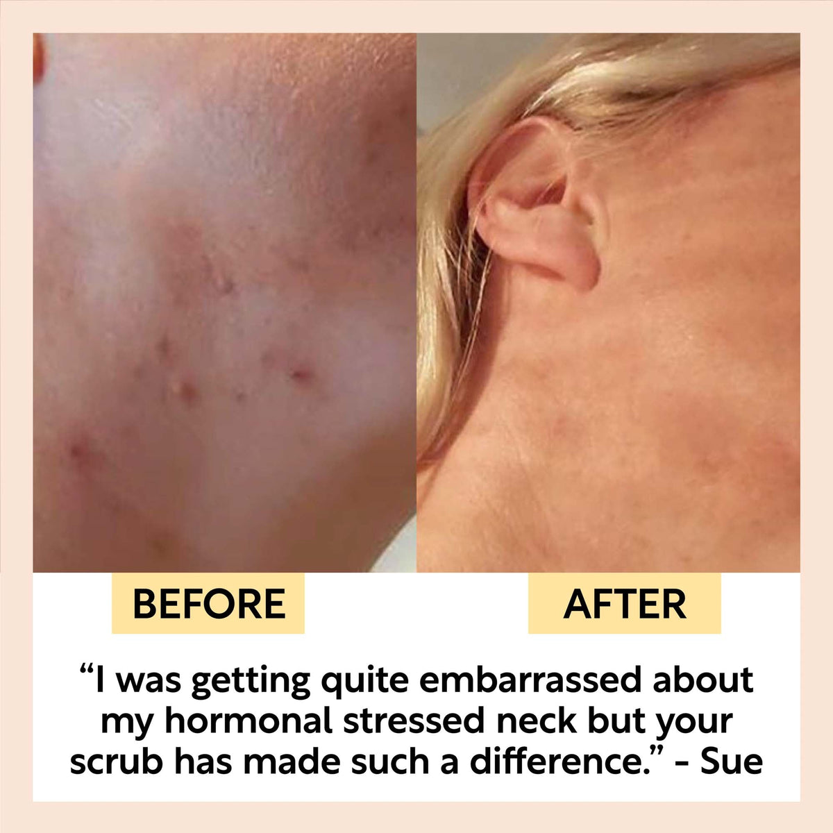 Face Scrub with Coffee + Rosehip Oil UpCircle