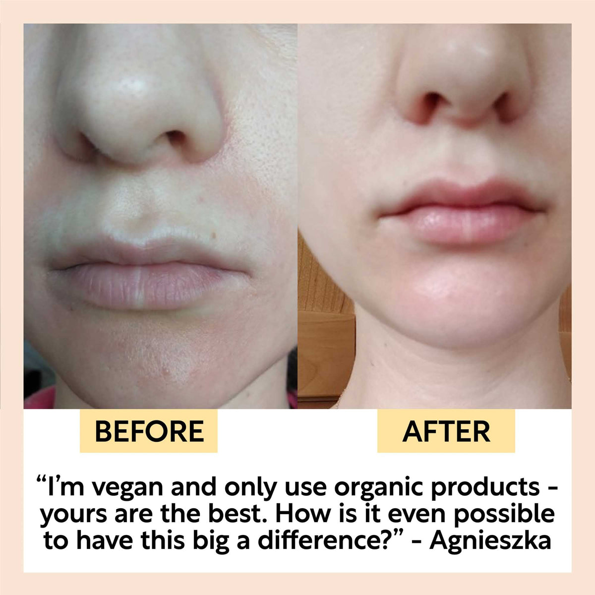 Hydration Skincare Set UpCircle