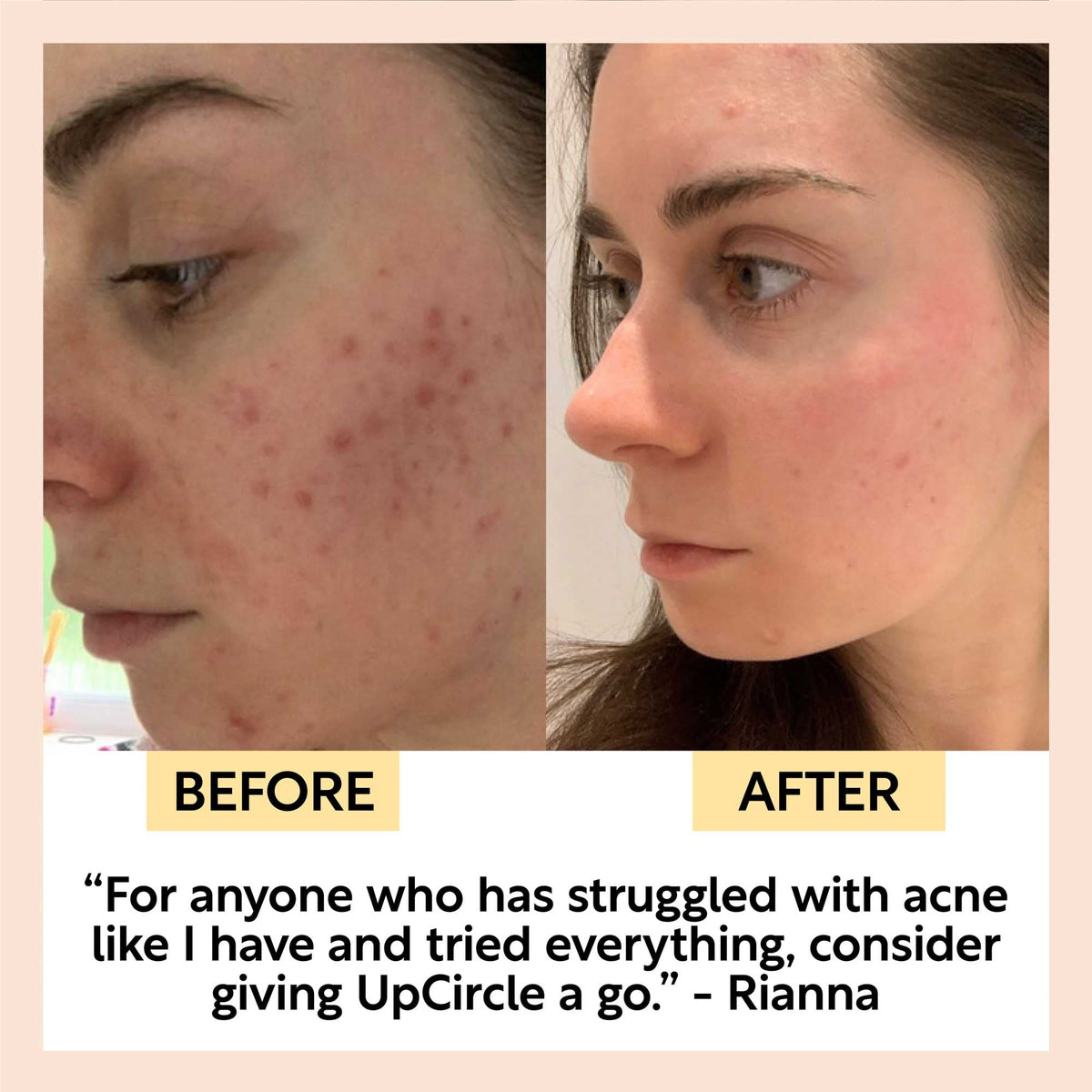 Travel-Size Skincare Bundle UpCircle