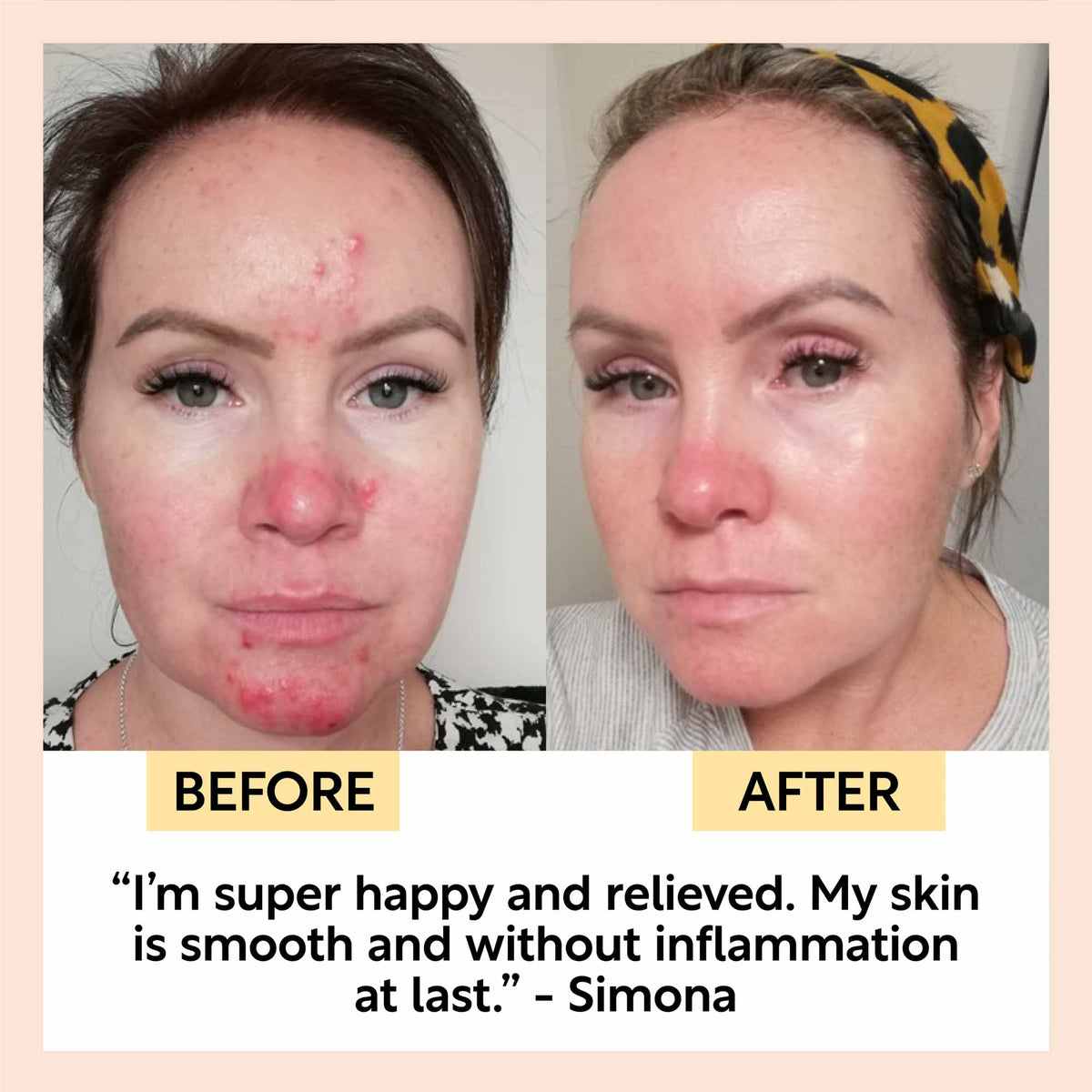 The Sensitive Skin Bundle UpCircle