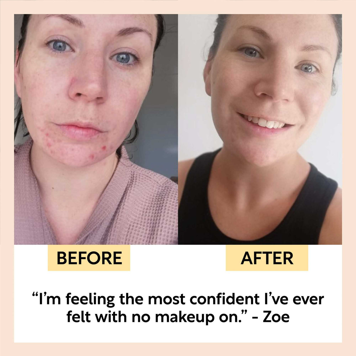Travel-Size Skincare Bundle UpCircle