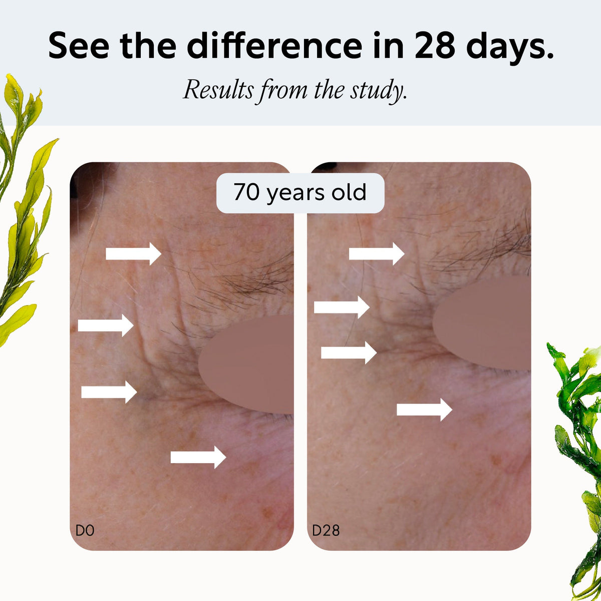 Overnight Eye Treatment with Retinol Exosomes UpCircle